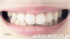 痛い・高い・歯に悪い…従来の歯科によるケアの常識を覆した画期的なデンタルケアです。